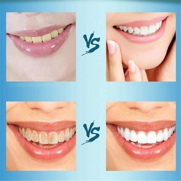 Toothpaste Teeth Whitening Refresh Breath Teeth Cleaning  Oral Care Dental Toothpaste Clean Teeth