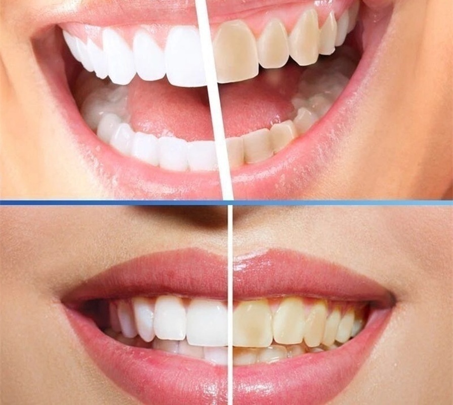 Teeth Whitening  Remove Plaque Stains Brighten Tooth Whitening Oral Hygiene Clean Serum Bleaching