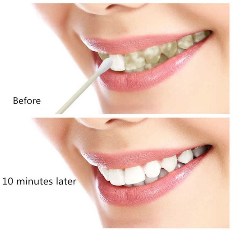Teeth Whitening  Remove Plaque Stains Brighten Tooth Whitening Oral Hygiene Clean Serum Bleaching