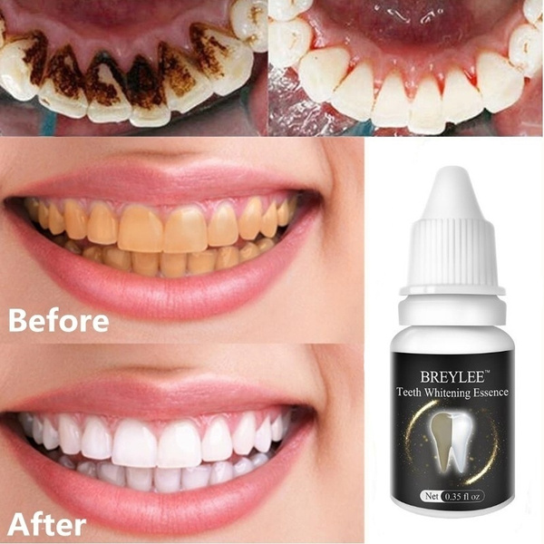 Teeth Whitening Essence Liquid Magic White Teeth System Teeth Whitening Smoke Stain Dental Liquid