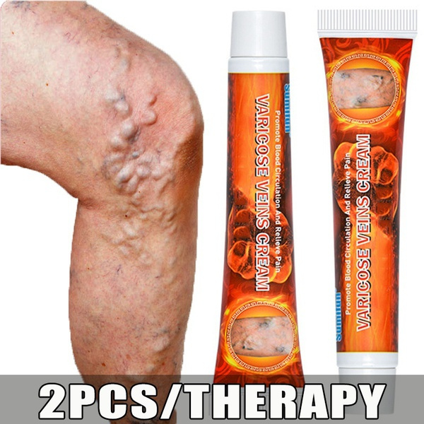 Varicose Veins Ointmnet Vasculitis Phlebitis Spider Cream  Removal Herbal Medical Plaster