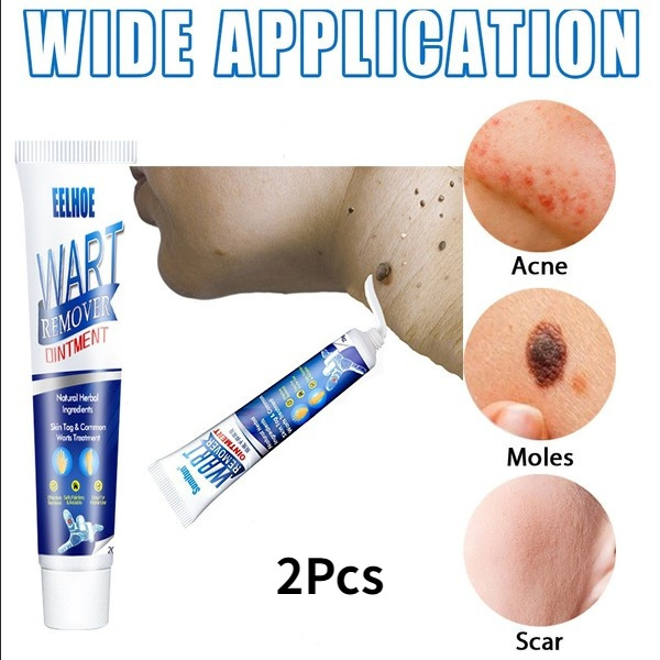 Hot Portable Body Instant Blemish Removal Gel Warts Treatment Cream Foot Care Skin Tag Remover