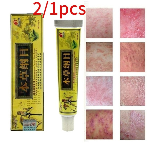 Original Herbal Creams Psoriasis Dermatitis and Eczema  Creams Acting on Skin Problems Skin Care