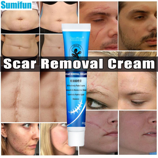 Professional  Snake Oil Ointment Remove Scar Cream Acne Hand Skin Face Care Natural Chinese Medical