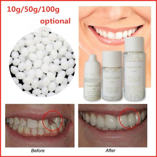 Temporary missing dental prosthetic kit teeth notch false teeth solid glue tooth adhesive