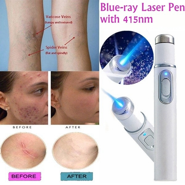 Blu-ray Acne Removing Blue Light Laser Pen Scar Acne Removal Anti Wrinkle Aging Therapy Acne Varicose Veins Treatment Pen Beauty Device