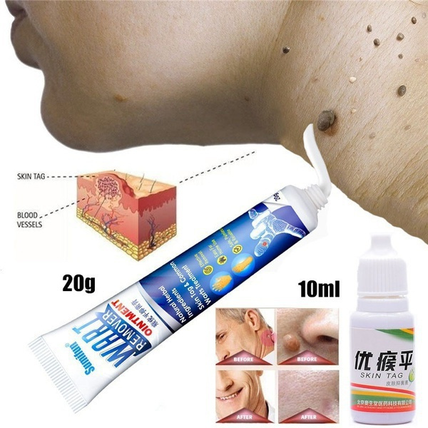 20g/10ml New Sumifun Warts Remover Ointment Wart Treatment Cream Skin Tag Remover Herbal Extract Foot Corn Antibacterial Warts Ointment