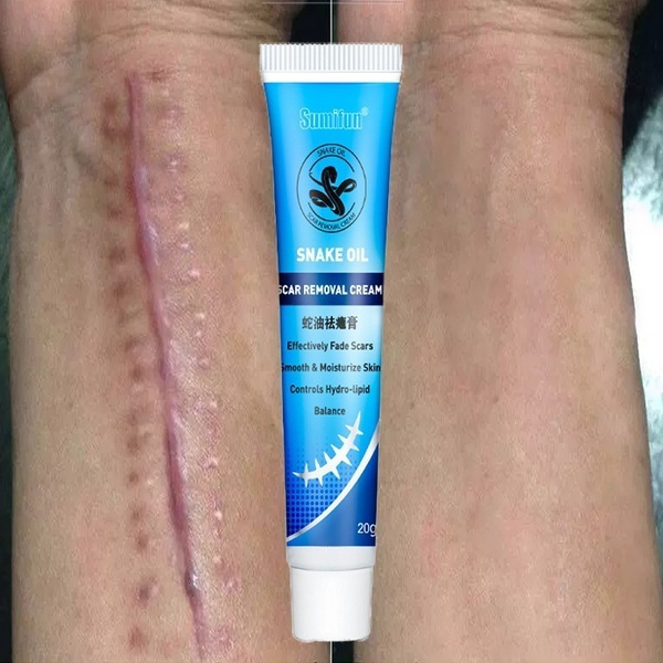 20g Professional Snake Oil Ointment Remove Scar Cream Acne Treatment Hand Skin Face Care Natural Chinese Medical Skin Care