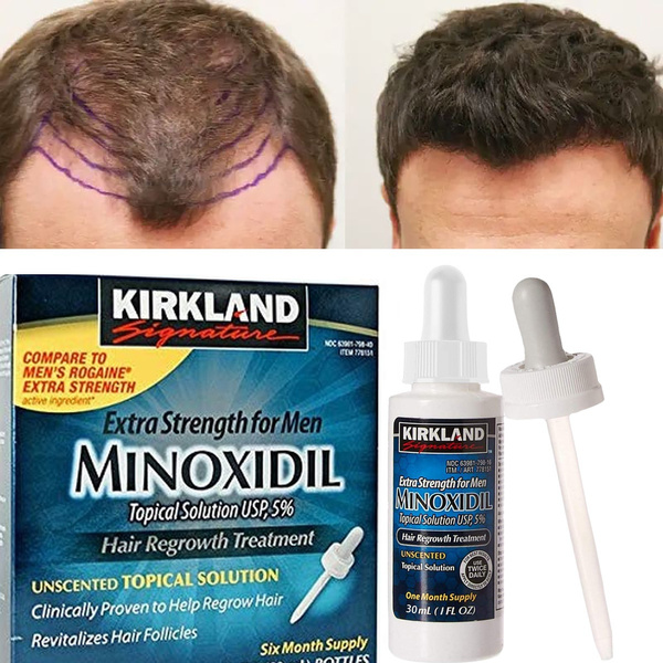 Minoxidil-3% Strength Hair Regrowth for Women,Minoxidil-5% Extra Strength Hair Regrowth for Men