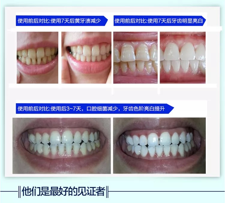 28pcs 3D White Gel Teeth Whitening Strips Oral Hygiene Care Double Strips Whitenin Bleaching Tools