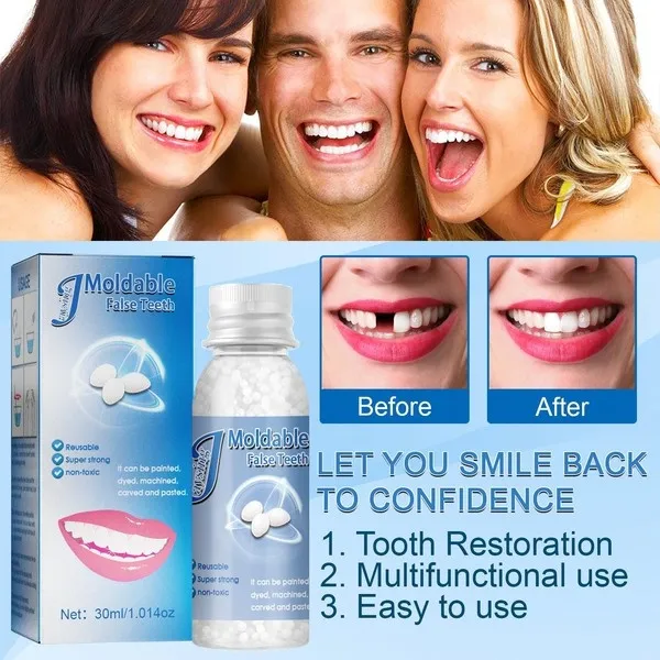 30ml Temporary Tooth Repair Kit False Teeth Solid Glue Denture For Missing Broken Teeth Moldable Tooth Filling False Teeth Tool