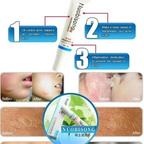 Switzerland Nuobisong Powerful Anti-Scar Anti-Black Spots Anti-Acne