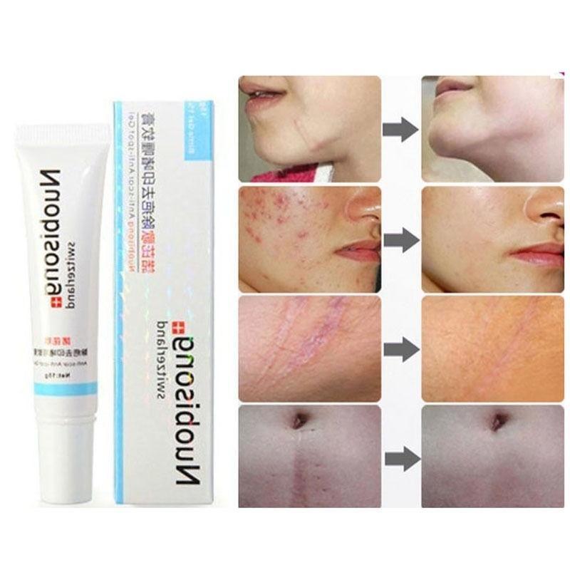 Switzerland Nuobisong Powerful Anti-Scar Anti-Black Spots Anti-Acne