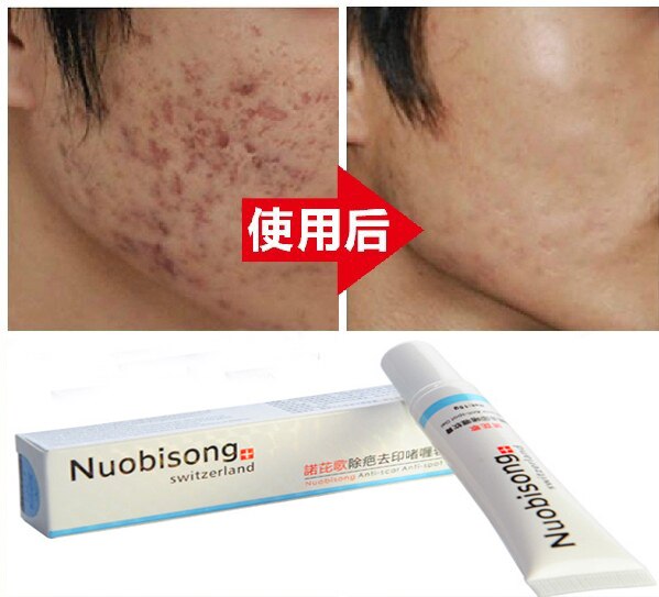 Switzerland Nuobisong Powerful Anti-Scar Anti-Black Spots Anti-Acne