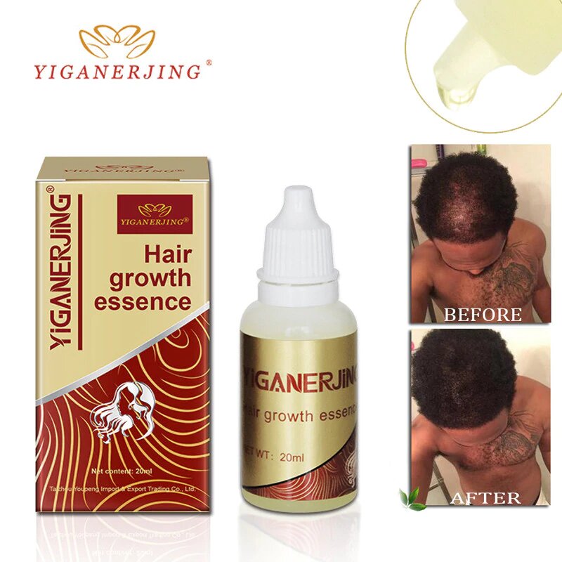 Original Hair Growth Oil Fast Restoration Natural Anti Hair Loss for Men & Women - Yiganerjing