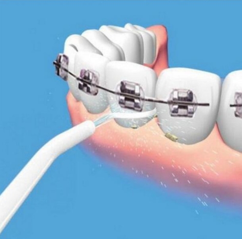 Oral Irrigator Dental Floss Oral Power Water Jet Pick Cleaning Irrigator Tooth Mouth Cleaner Care