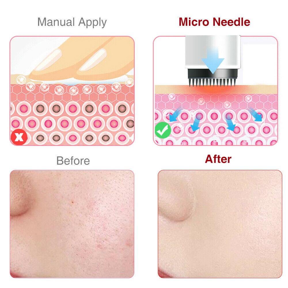 Auto Electric Derma Pen Micro Needle Skin Therapy Beauty Anti-aging Machine SPA