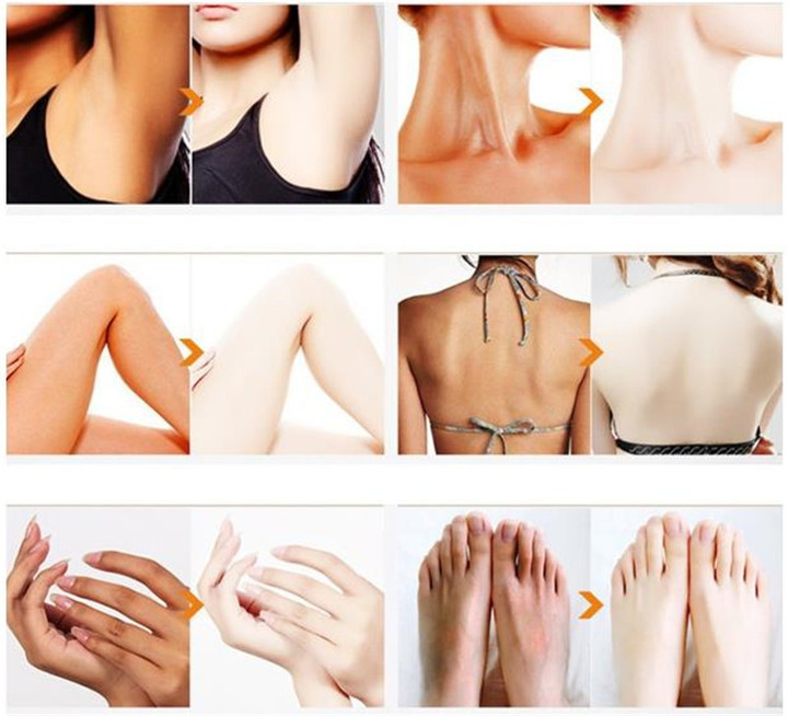 120ml Beauty Body Face Whitening Cream for Dark Skin Bleaching Brightening Skin Lotion