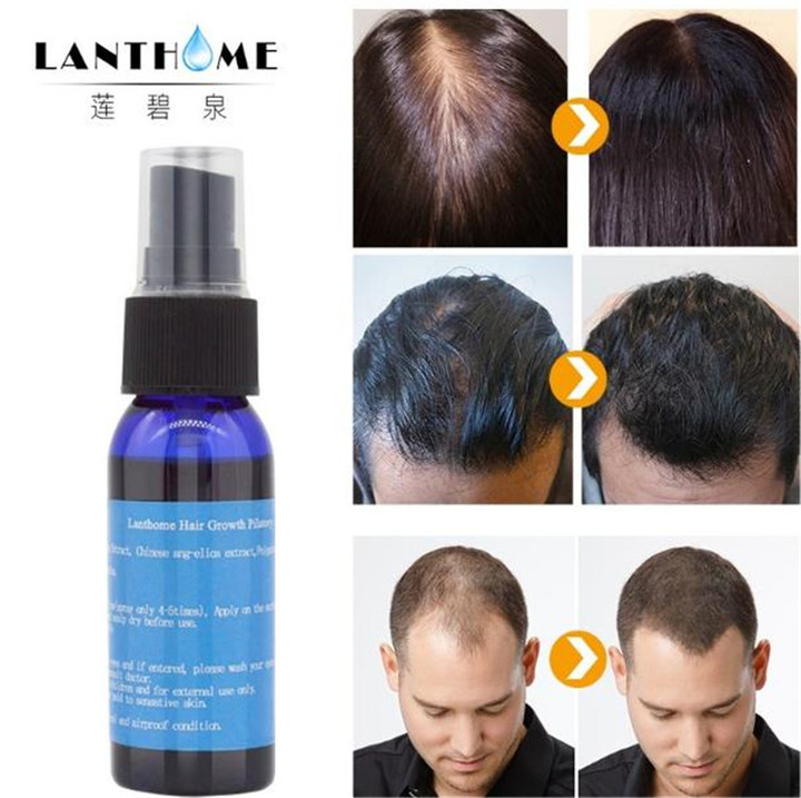 Hair Loss Treatment Kenya