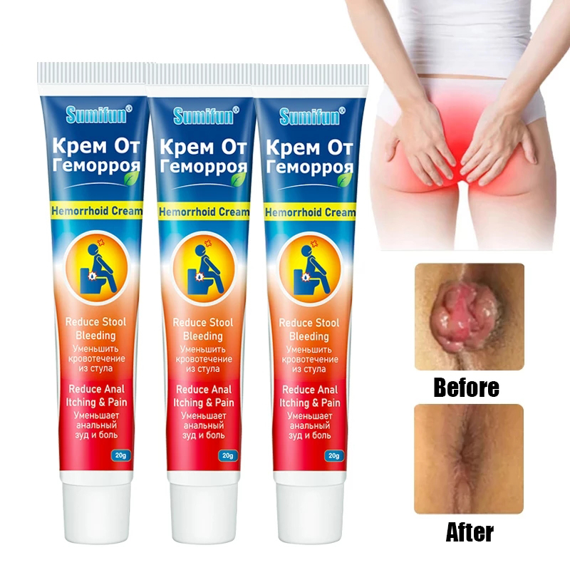 Hemorrhoids Treatment Cream hinese Herbal Extracts Internal External Piles Fissure Pain Relief