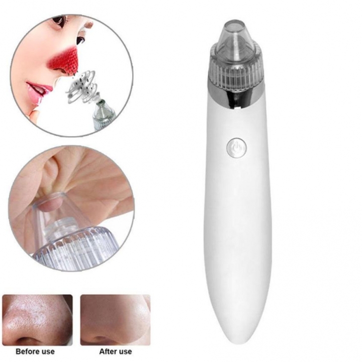 Electric Facial Pore Blemish Cleanser BlackHead Cleaner Acne Remover Tool Kit Skin Care