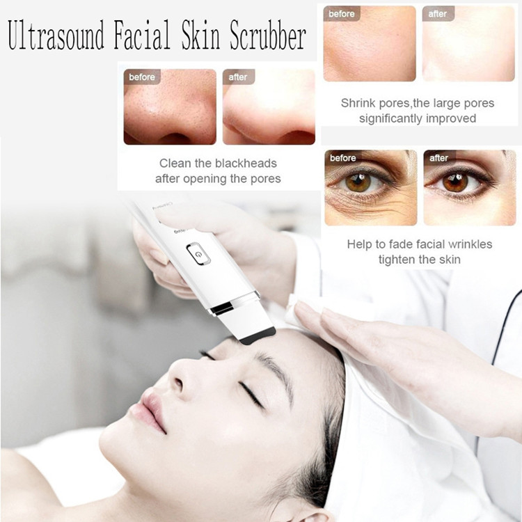 Ultrasonic Scrubber for Face Skin  Face Exfoliator Cleaner -Blackhead Acne Removal Deeply Clean
