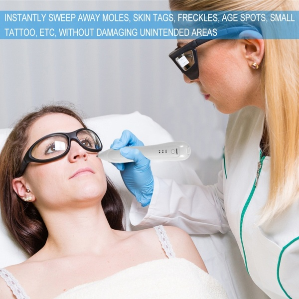 SuperMind Three Levels Adjustable USB Mole Freckle Removal Pen Spot Tattoo Remover Device