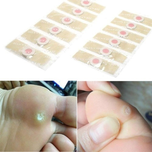 12Pcs Feet Corns Removal Patch Pain Relief Warts Remover Foot Callus Medical Plaster
