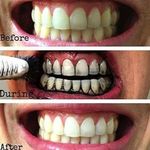 Dr. Rashel  Charcoal Teeth Whitening Toothpaste