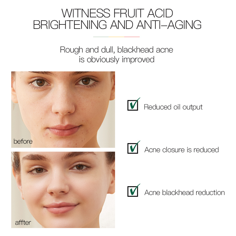 HW ANFANY Fruit acid facial cleanser weak acid Skin care suitable for most skins used for facial cleaning
