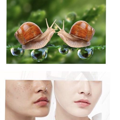 Snail Repairing Cream Anti-Aging Elasticity Sunburn Scars and Dark Spots
