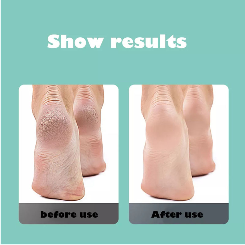 BL USB Rechargeable Foot Grinder Pedicure Tools Feet Care Remover Machine Dead Skin Callus Polisher