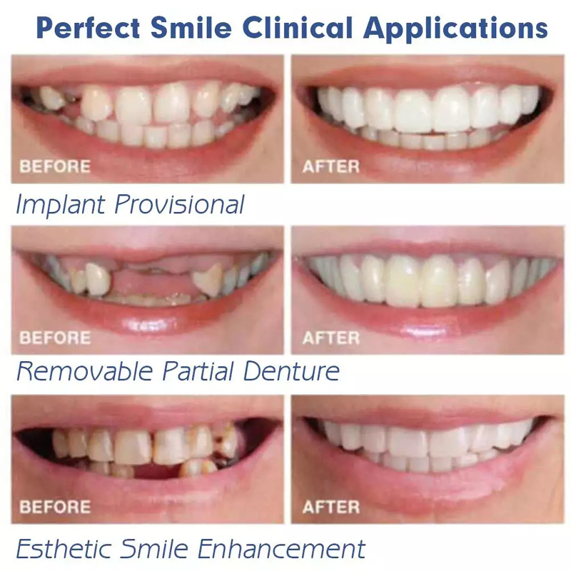 BL Upper Lower False Teeth Cover Veneers Comfort Fit Flex Denture Braces Teeth Straightener