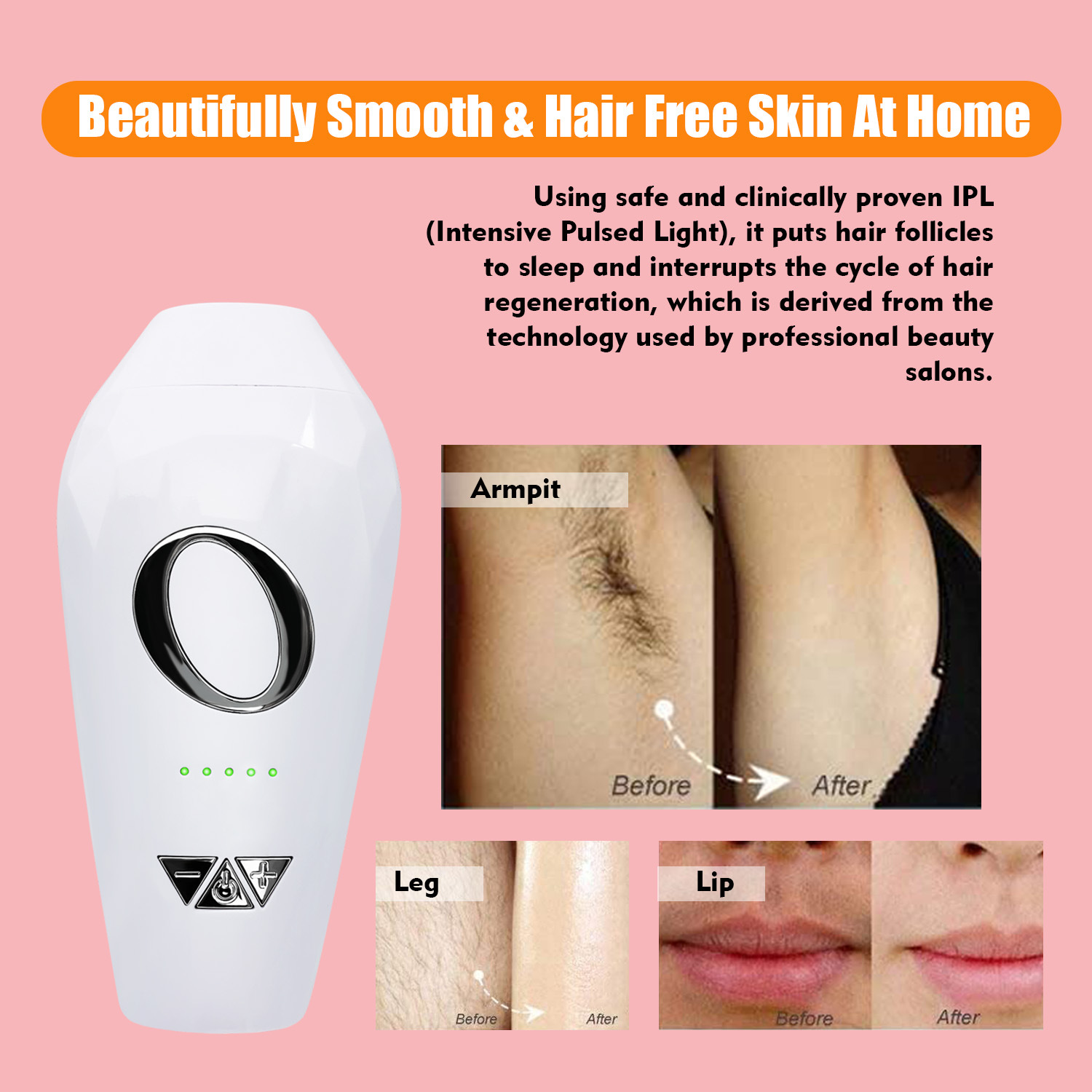 IPL photon freezing point rejuvenation beauty instrument household private leg hair removal