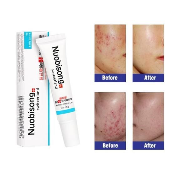 Nuobisong Skin Restoration Dark Spots, Stretch Marks, Scald, Scar Gel