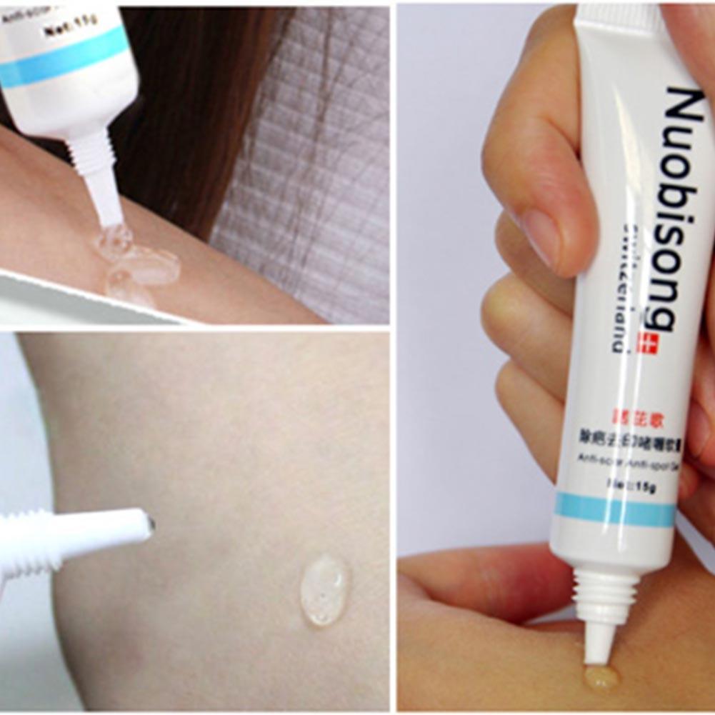 Nuobisong Skin Restoration Dark Spots, Stretch Marks, Scald, Scar Gel
