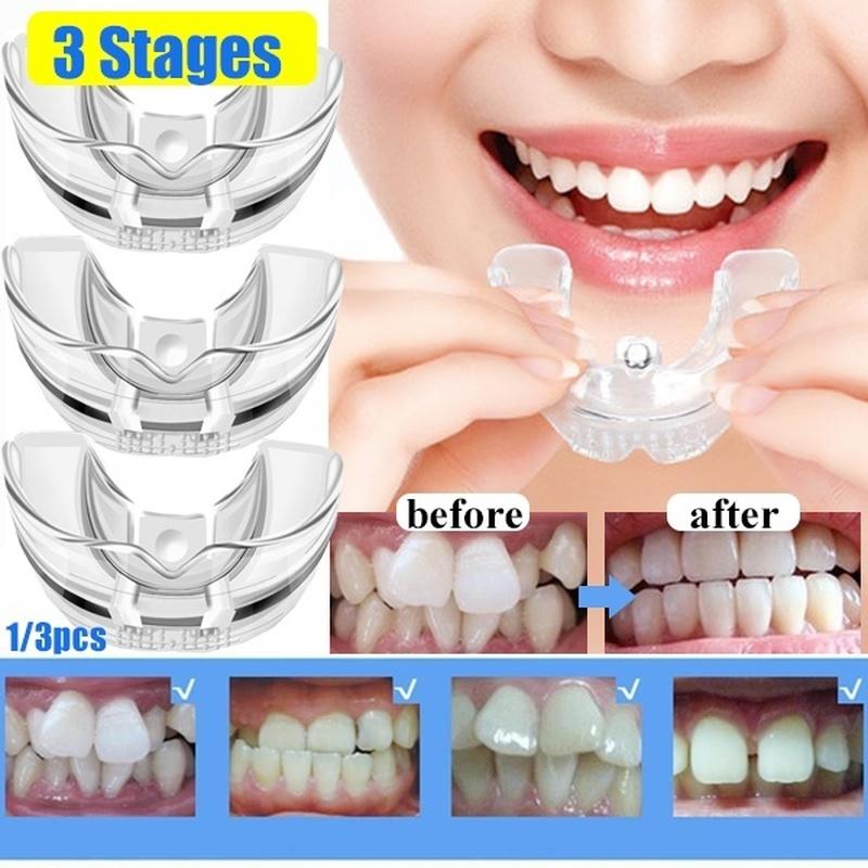 USA Professional Teeth Corrector Braces (3 Stages) + Case