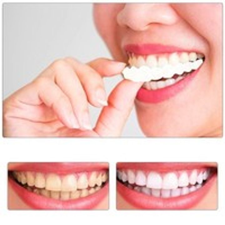 2Pcs Teeth Veneers Upper Und Lower Braces Reusable Snaps Perfect Smiley Whitening Dentures