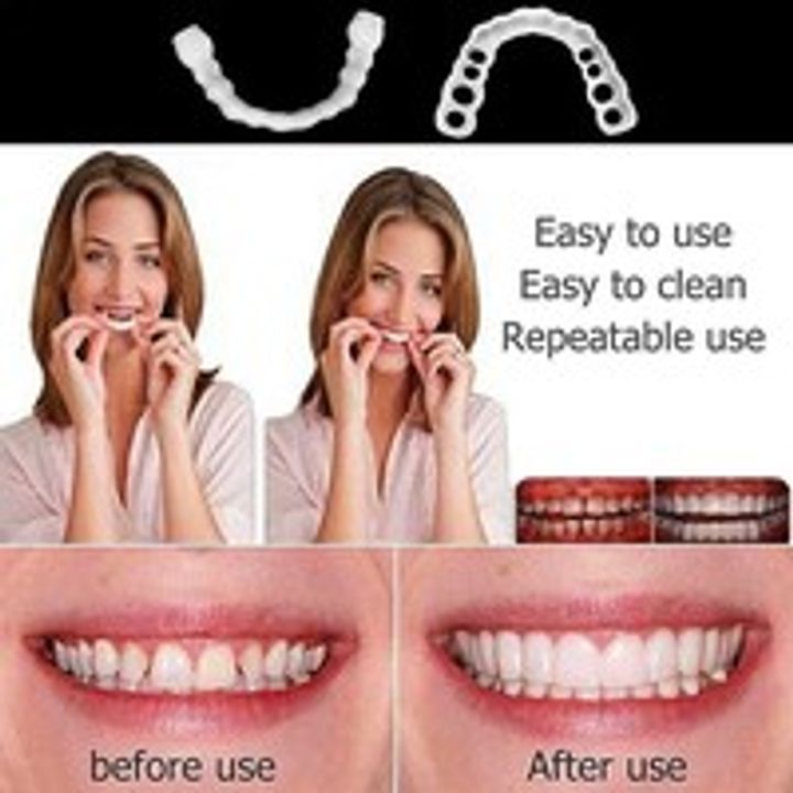 Snap On Smile Teeth Veneers Whitening Cosmetic Denture Instant Perfect Smile Teeth Fake Tooth Cover