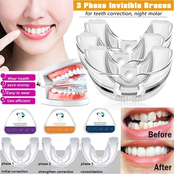 3 Phase Silicone Invisible Tooth Set Teeth Tray Night Molar Dental Orthodontic Appliance Retainer