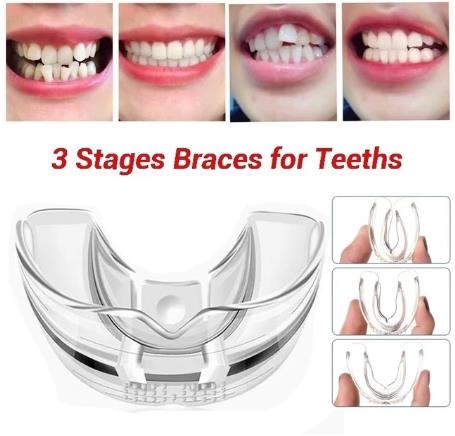 Dental Tooth Orthodontic Appliance Trainer Dental Braces Teeth Trainer For Adults Orthodontic Braces