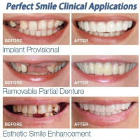Comfortable Whitening Teeth Fake Cosmetic Tooth Denture Silicone Smile Veneers Beauty Tool False