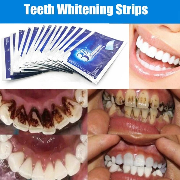 Gel Teeth Whitening Strips Oral Hygiene Care  Elastic Teeth Strips Whitening Dental Bleaching Tools