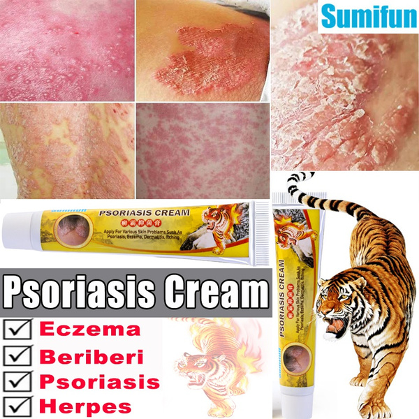Tiger Balm Skin Problem Treatment Eczema Psoriasis Dermatitis Ointment Herbal Antibacterial Cream