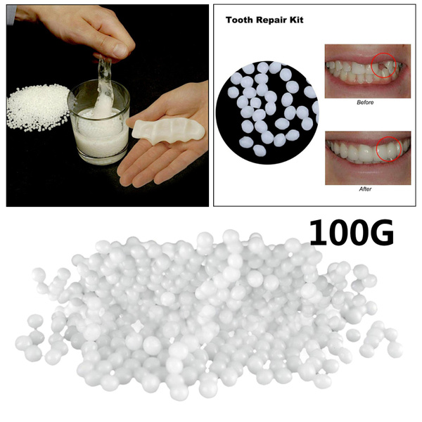 Temporary Tooth Repair Kit Thermal Molding Repair Fitting Bead Denture Repair Fake Teeth Veneer for Filling