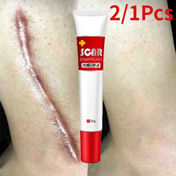 Acne Scar Removal Cream Skin Repair Face Cream Acne Spots Acne Anti Scar Stretch Marks Cream