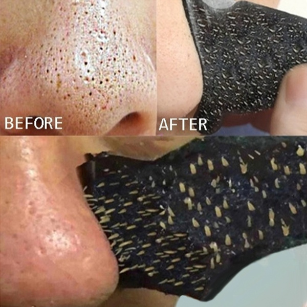 Blackhead Acne Removal Strong Stickers Nose Blackhead Pore Cleansing Cleaner