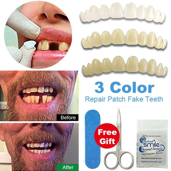 Ultra Thin Resin Whitening Denture Patch Fake Teeth Tooth Repair Veneers Kit for Missing