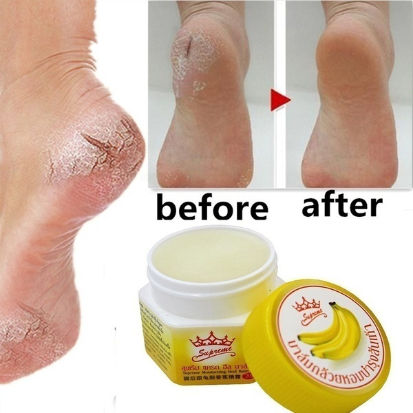 Effective Odor Treatment Nourish Anti Chapped Anti-Drying  Skin Care Product Dead Skin