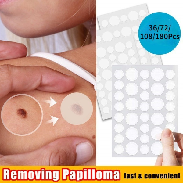 180pcs Skin Tag Removal Treatment Patch Face Care Mole Remover Wart Remover Hands Feet Body Corn Plaster Acne Warts Treatment(8/12mm)